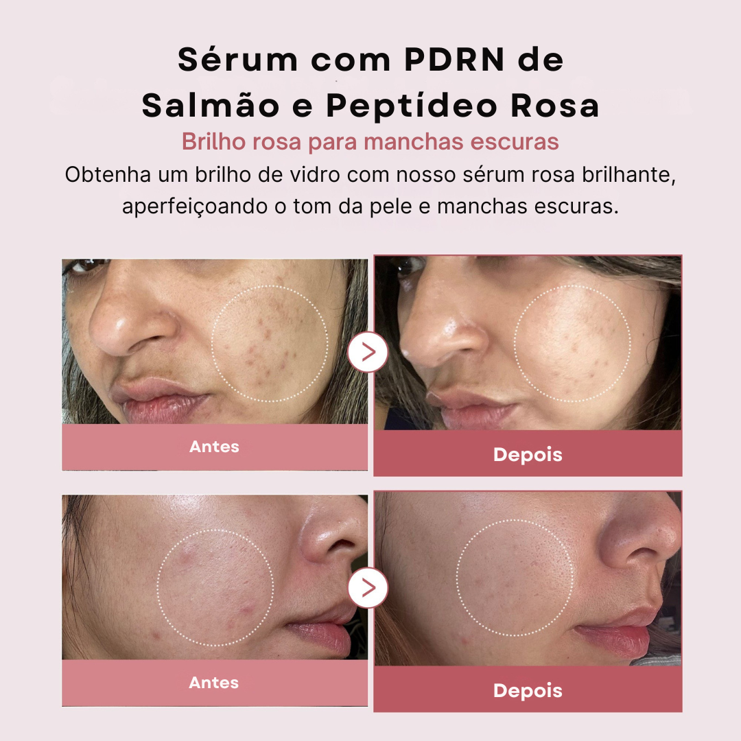 Suero PDRN con péptidos rosas