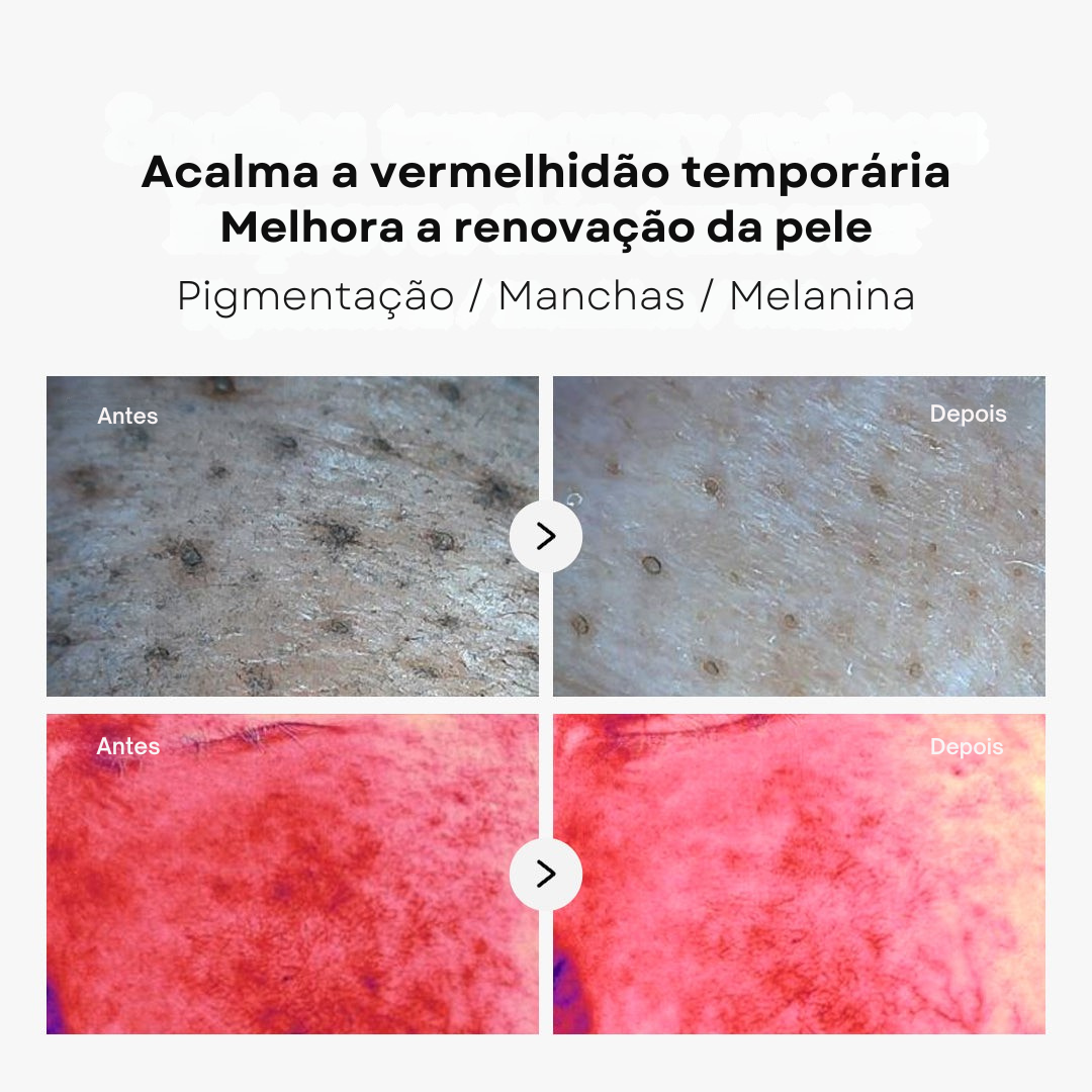 Skincare coreano com ácido succínico Medicube
