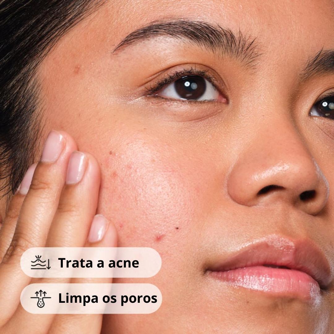 The Ordinary Salicylic Acid 2% Solution Sérum Antiacne