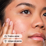 The Ordinary Salicylic Acid 2% Solution Sérum Antiacne