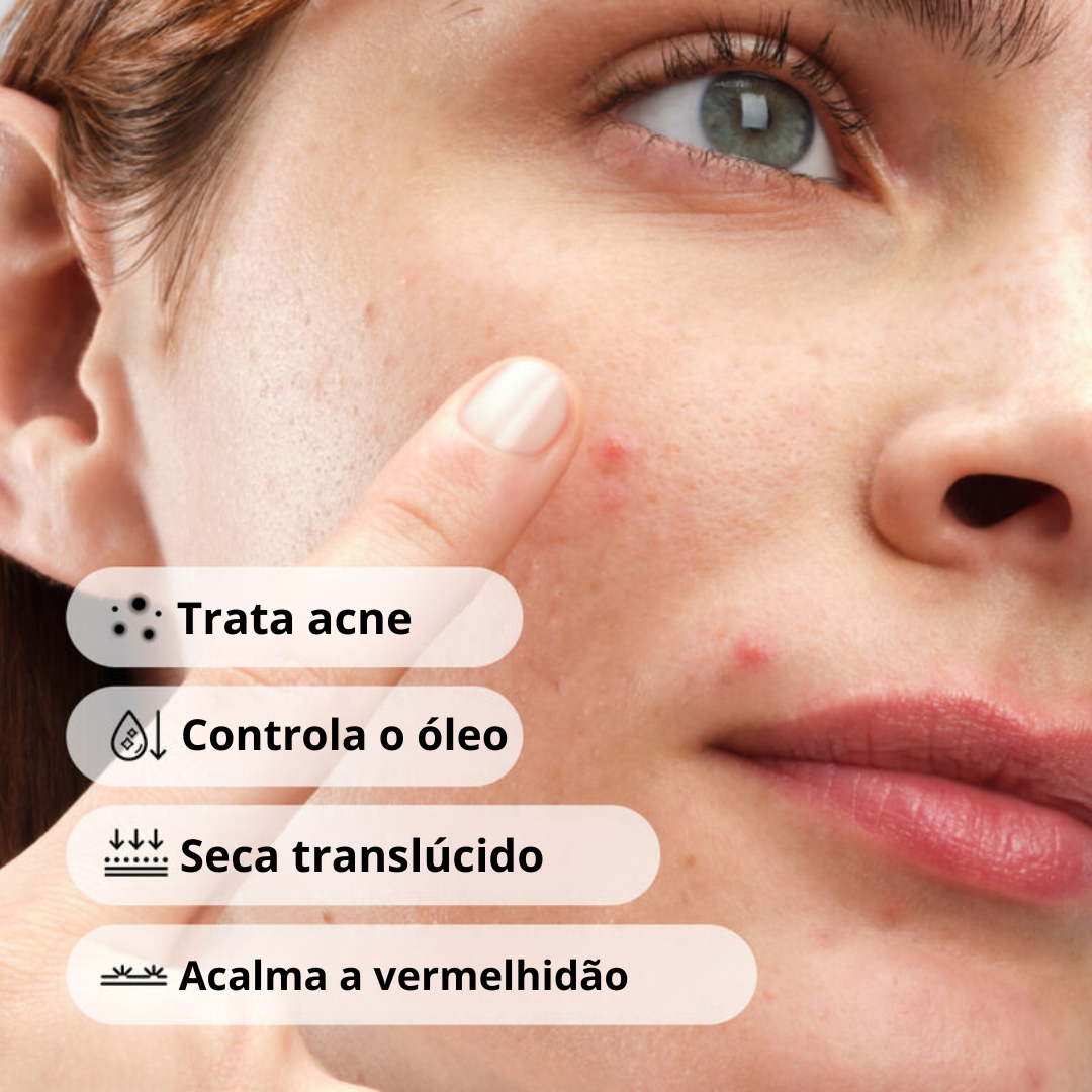 The Ordinary Sulfur 10% Powder-to-Cream Concentrate Tratamento Antiacne com Enxofre