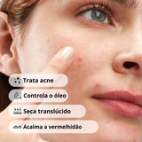 The Ordinary Sulfur 10% Powder-to-Cream Concentrate Tratamento Antiacne com Enxofre