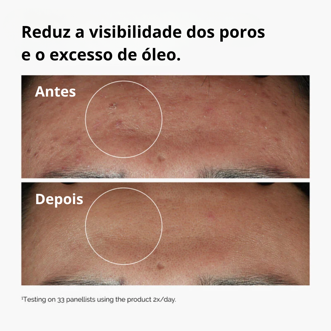 The Ordinary Niacinamide 10% + Zinc 1% Sérum Controlador de Oleosidade
