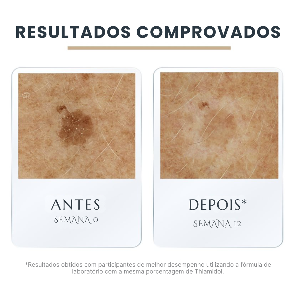Eucerin Hyaluron-Filler + Elasticity 3D Sérum Antissinais